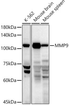 Western Blot: MMP-9 AntibodyAzide and BSA Free [NBP3-03760]